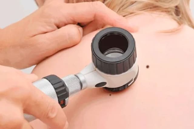 Dermatoscopia
